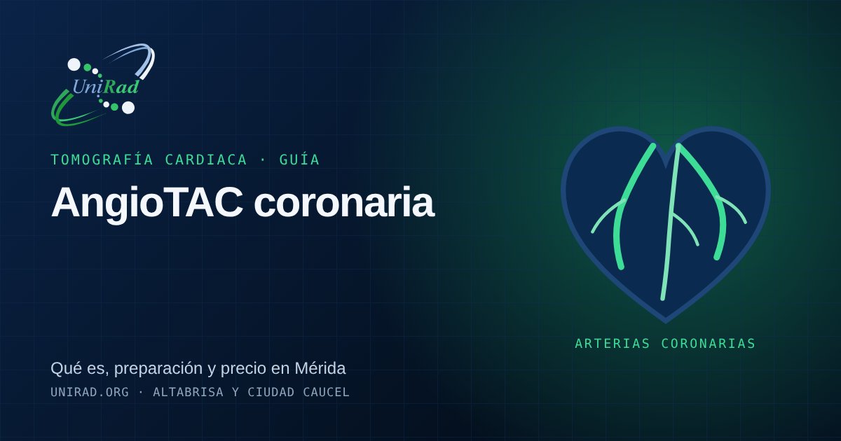 Ilustración de un corazón con las arterias coronarias resaltadas