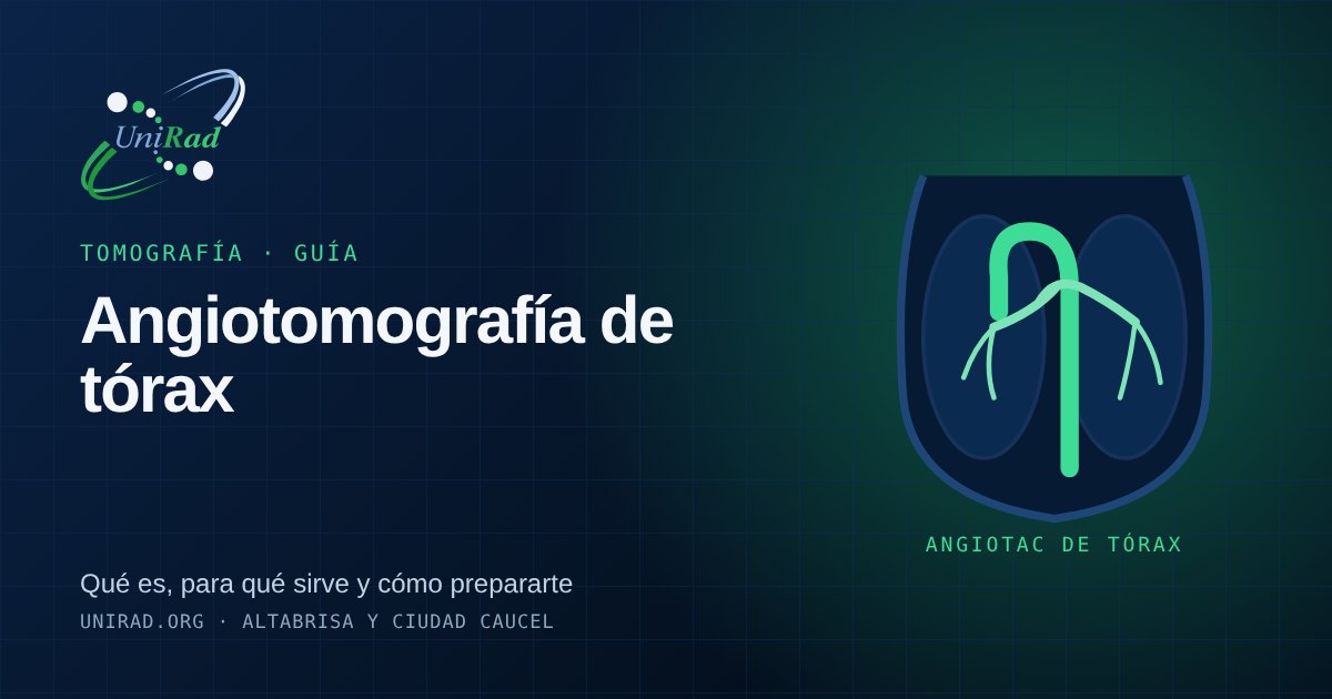 Ilustración de la aorta y las arterias pulmonares resaltadas con contraste