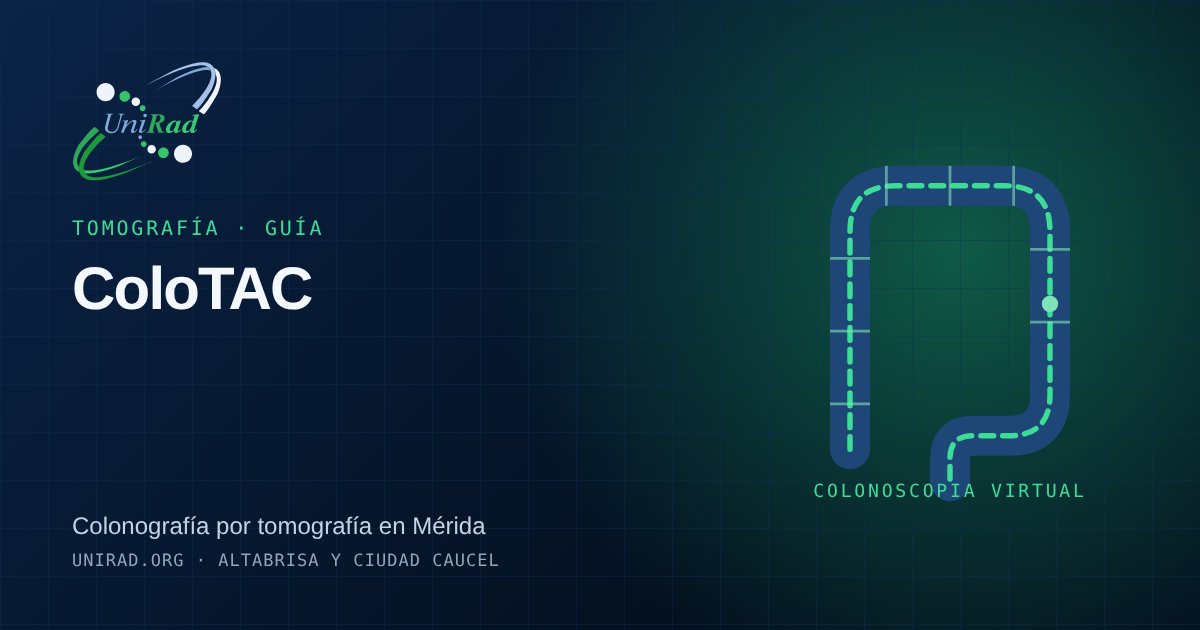 Ilustración del intestino grueso reconstruido en 3D por tomografía
