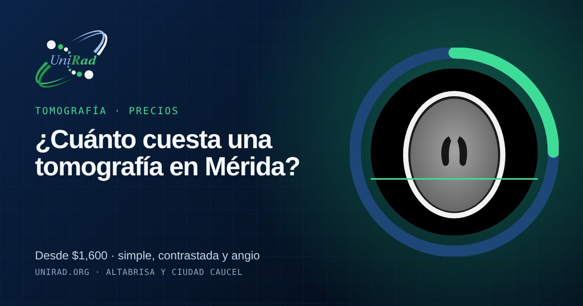Ilustración de un tomógrafo con el texto: precios de tomografía en Mérida
