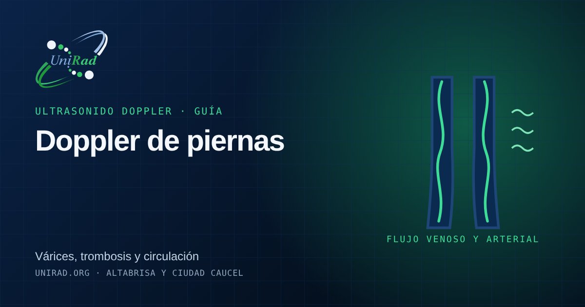 Ilustración de las venas de las piernas con el flujo sanguíneo resaltado