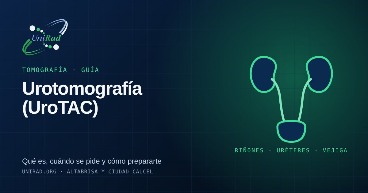 Ilustración de los riñones, los uréteres y la vejiga